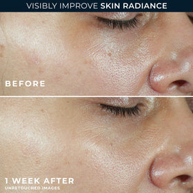 RoC label close-up highlighting ingredients, Vitamin C, peptides