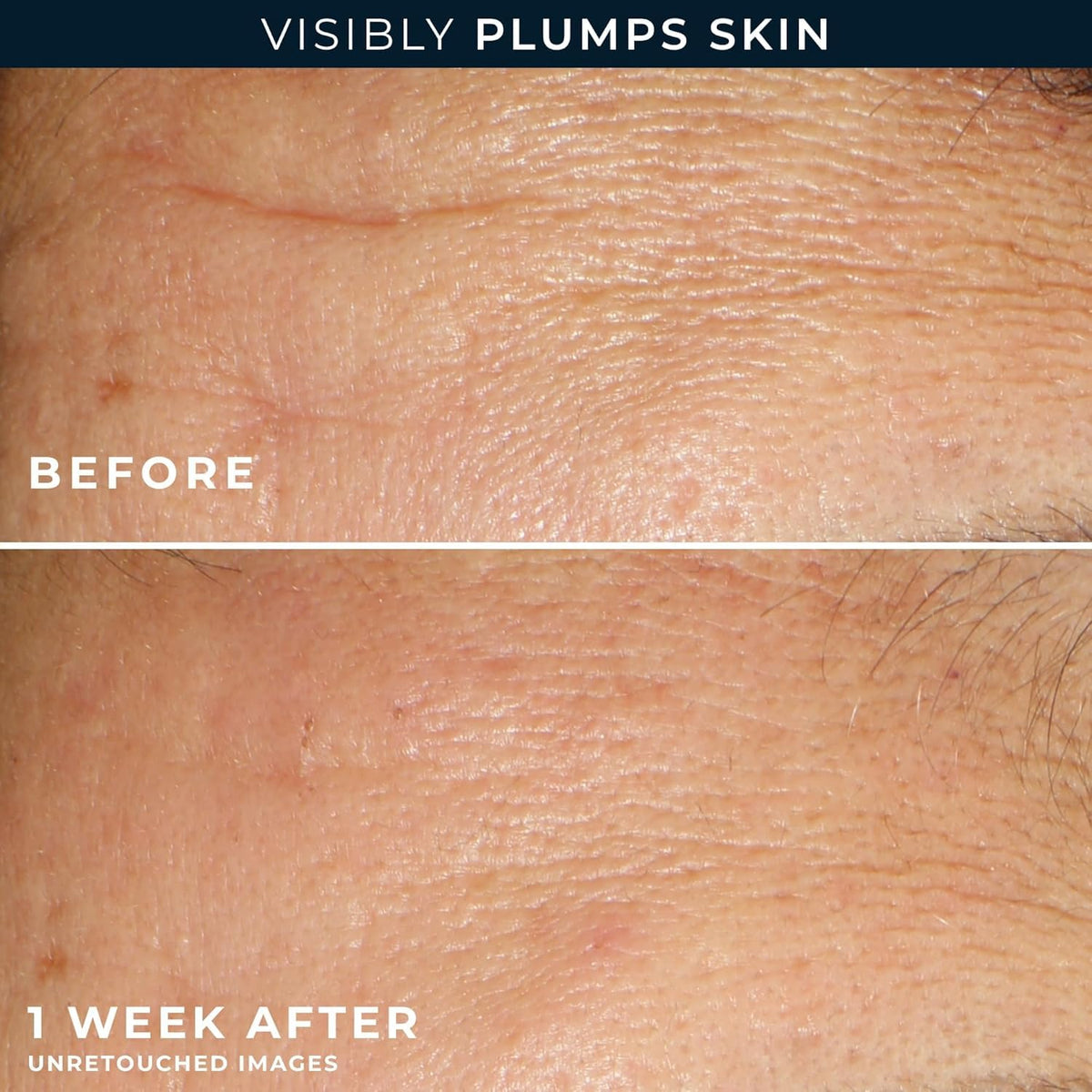 RoC hyaluronic serum drop on skin texture showing lightweight hydration and visible plumping