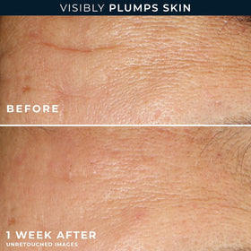 RoC hyaluronic serum drop on skin texture showing lightweight hydration and visible plumping
