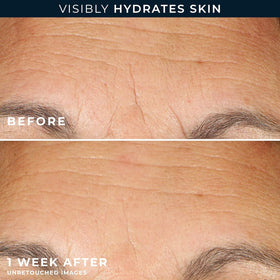 RoC hand twisting open a capsule to reveal serum, demonstrating protected freshness and ease