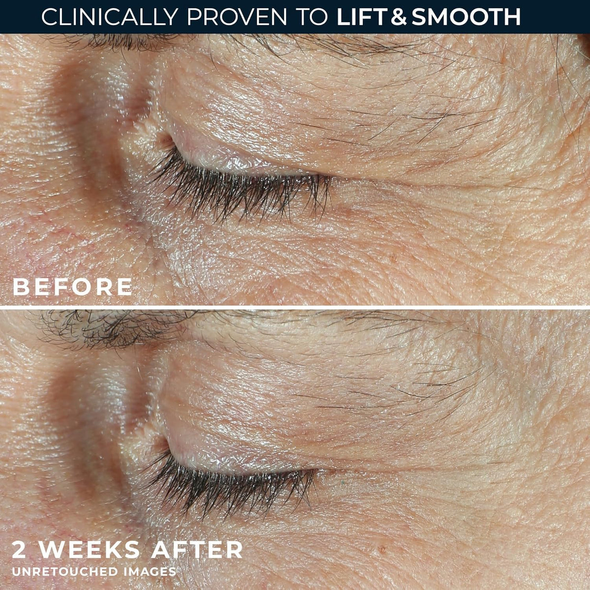 RoC under-eye cream texture close-up showing smoothing peptide-rich emulsion