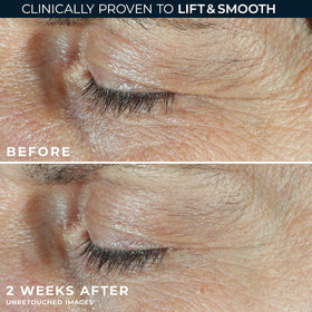 RoC under-eye cream texture close-up showing smoothing peptide-rich emulsion