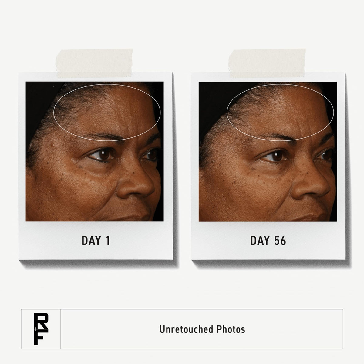 RODAN + FIELDS cleanser dispensed on fingertip demonstrating easy application