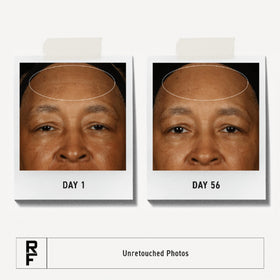 RODAN + FIELDS applying SPF on hand demonstrating quick-absorbing benefit