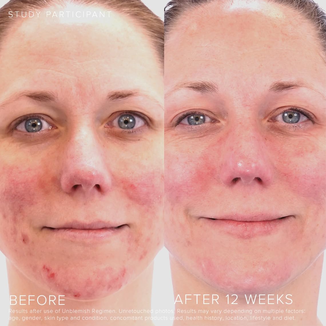 Rodan + Fields texture close-up showing lightweight formula and spreadability