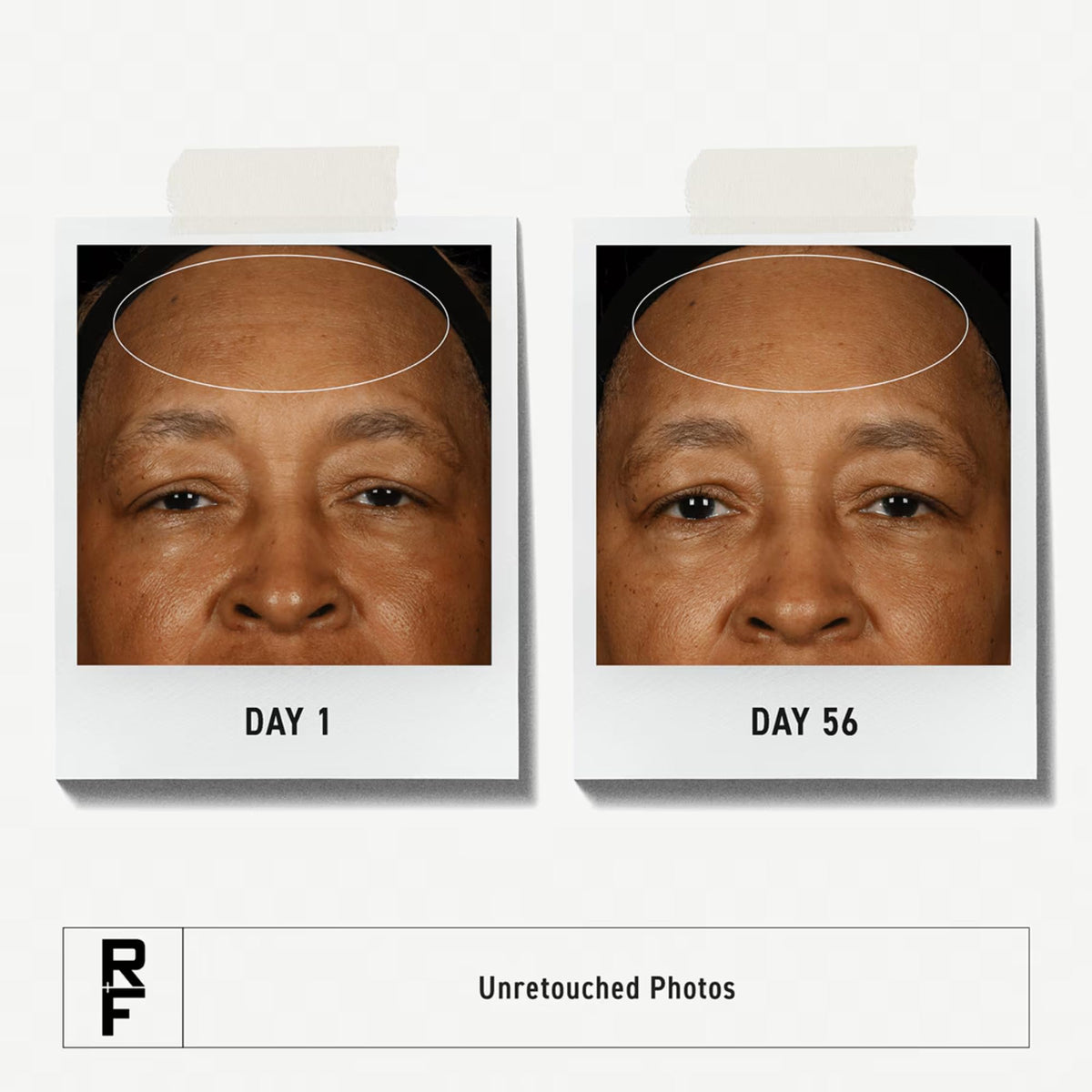 RODAN + FIELDS clay cleanser texture closeup showing gentle deep-clean benefit