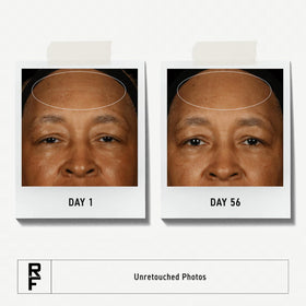 RODAN + FIELDS clay cleanser texture closeup showing gentle deep-clean benefit