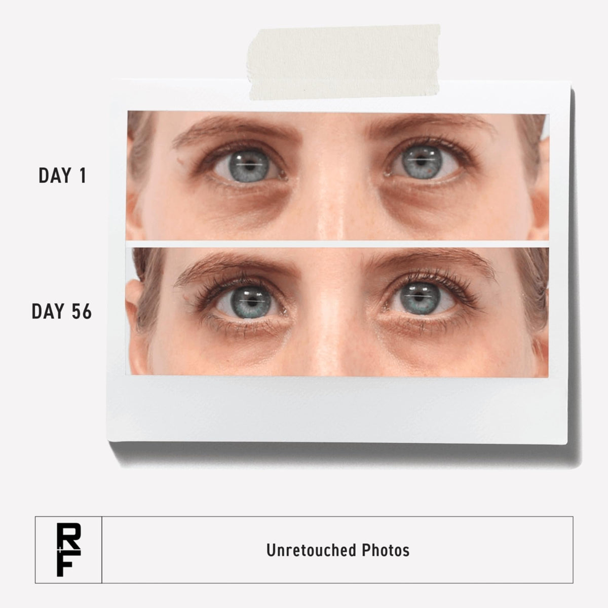 RODAN + FIELDS cap and nozzle close-up showing dispensing design and hygienic use