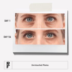 RODAN + FIELDS cap and nozzle close-up showing dispensing design and hygienic use