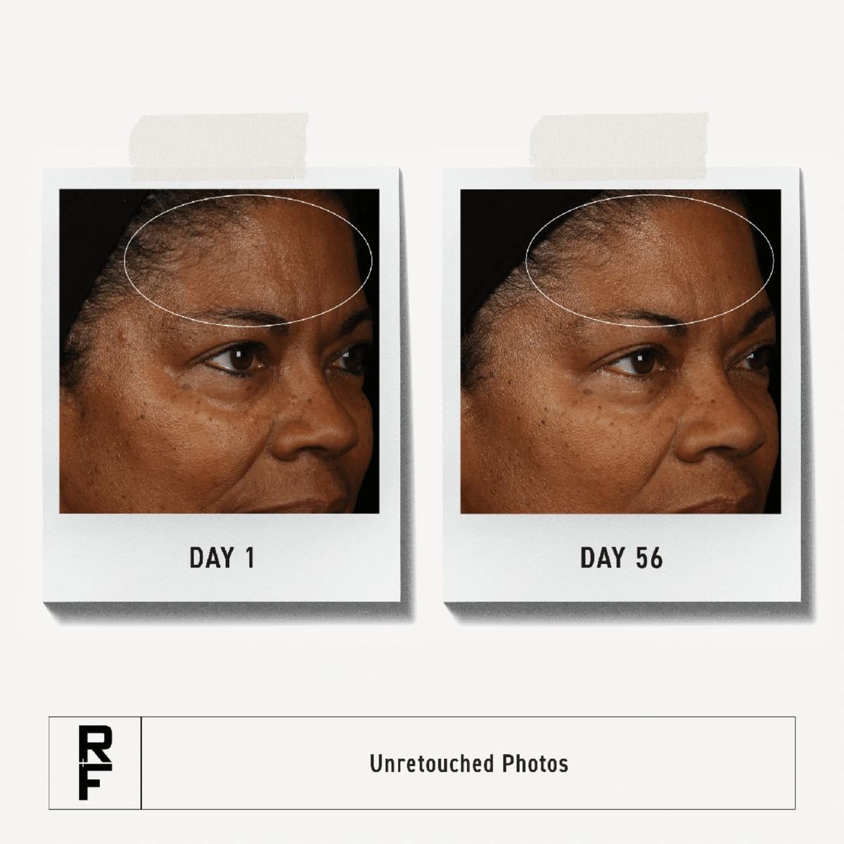 RODAN + FIELDS cream on fingertips demonstrating easy spread and smoothing effect
