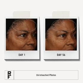 RODAN + FIELDS cream on fingertips demonstrating easy spread and smoothing effect