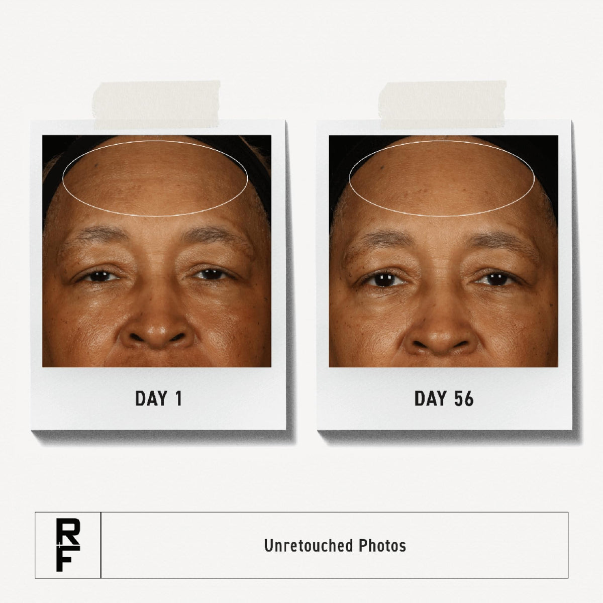 RODAN + FIELDS open jar showing creamy texture and deep hydration benefit