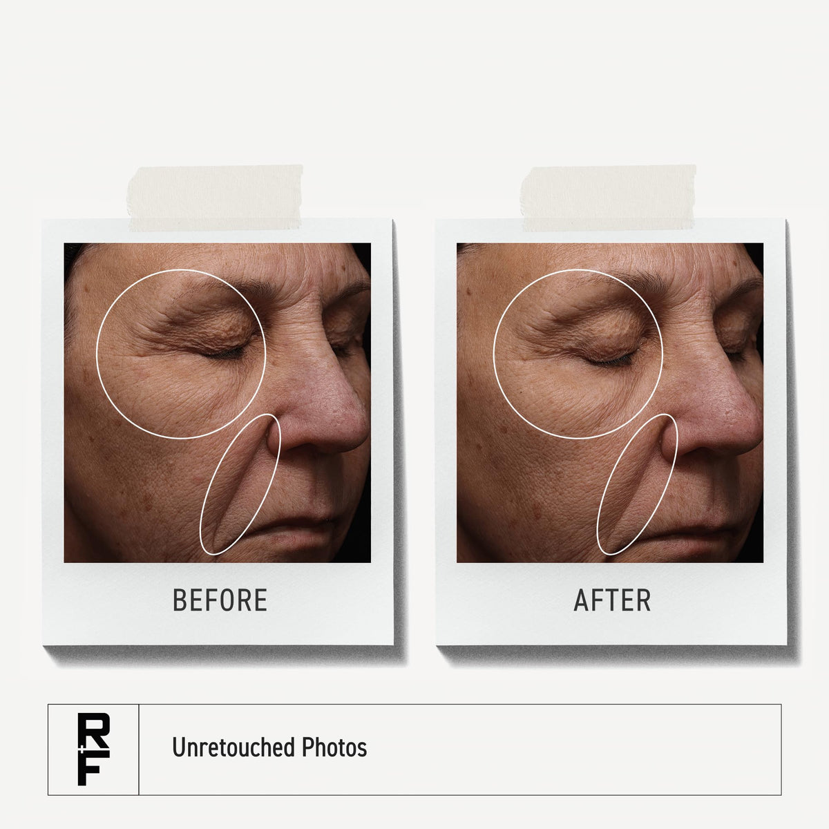 Rodan + Fields serum beside moisturizer to show layering in routine benefit