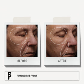 Rodan + Fields serum beside moisturizer to show layering in routine benefit