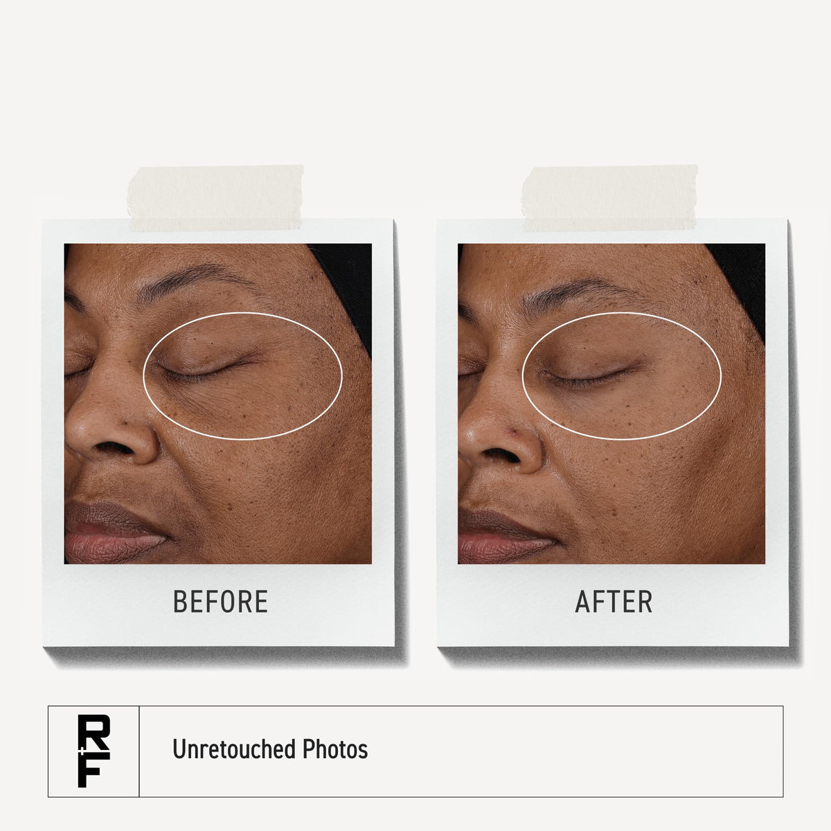 Rodan + Fields bottle in a hand for size perspective and travel-ready benefit