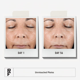 Rodan + Fields dropper releasing clear serum showing lightweight texture and absorption benefit