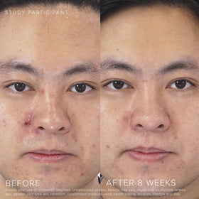 RODAN + FIELDS sized in hand illustrating compact travel-friendly tube