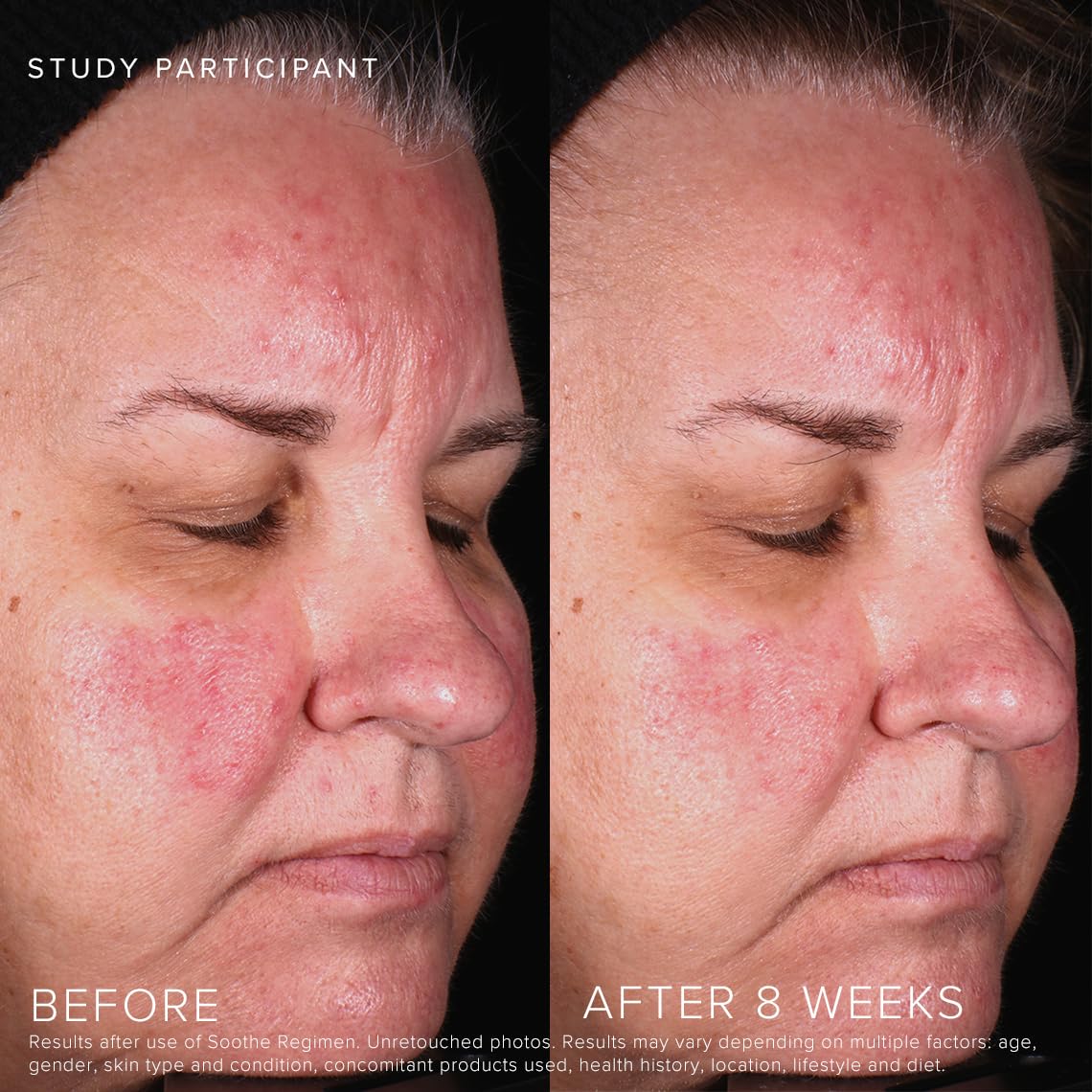Rodan + Fields pump dispensing gel for controlled, no-waste application benefit