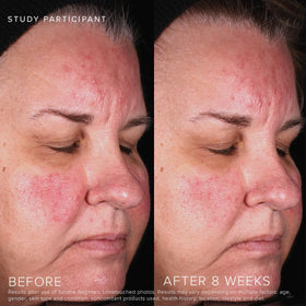 Rodan + Fields pump dispensing gel for controlled, no-waste application benefit