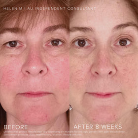 RODAN + FIELDS tube inside travel kit showing convenience for on-the-go reapplication
