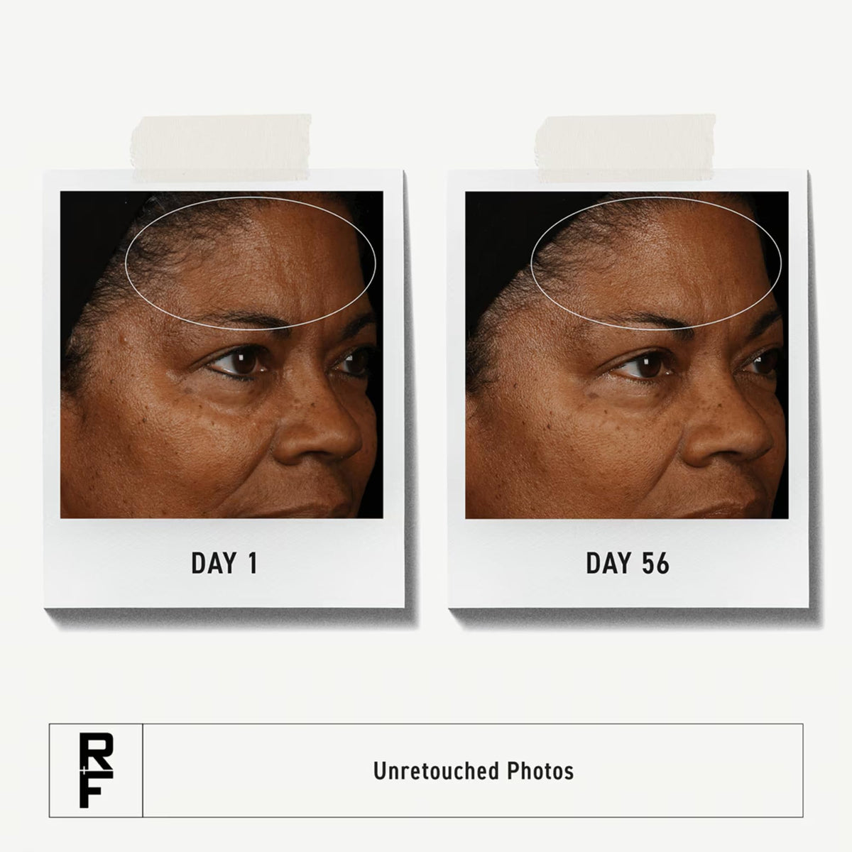 RODAN + FIELDS toner front packaging highlighting clarifying benefit