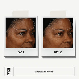 RODAN + FIELDS toner front packaging highlighting clarifying benefit