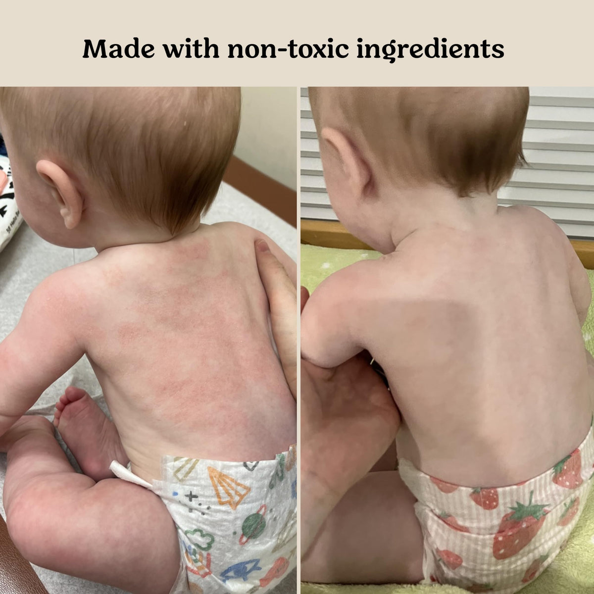 Roe Wellness Lactococcus ferment lysate ingredient close-up showing probiotic support