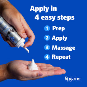 Rogaine being applied to scalp demonstrating targeted crown treatment benefit