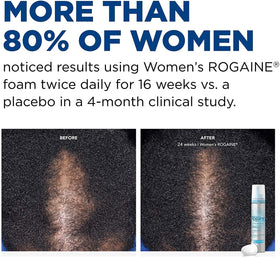 Rogaine bottle next to ruler showing 2.11 oz size and travel convenience benefit