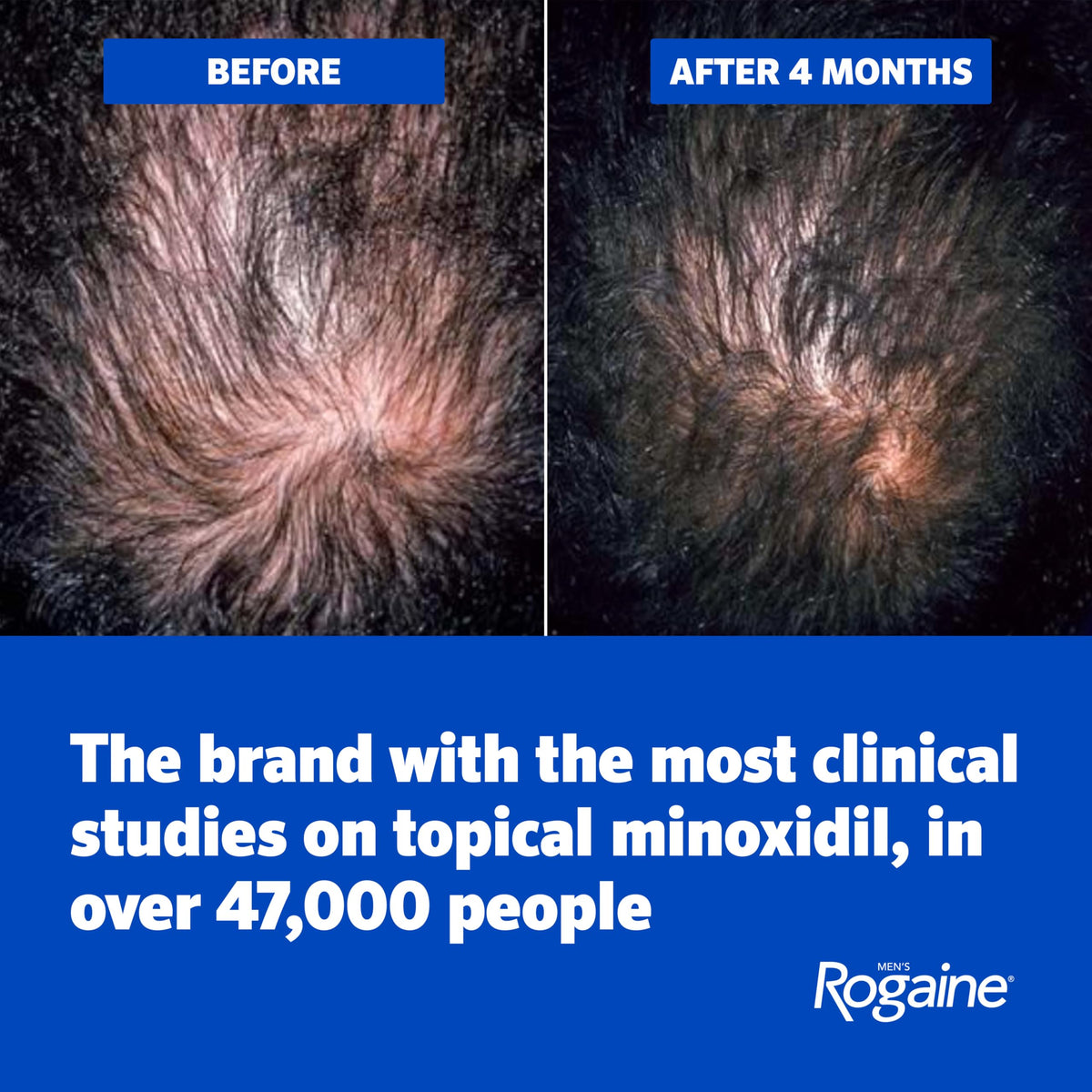 Rogaine label close-up showing active minoxidil and scalp-conditioning benefit