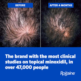 Rogaine label close-up showing active minoxidil and scalp-conditioning benefit