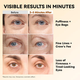 RONKIE being applied under-eye demonstrating visible immediate tightening benefit