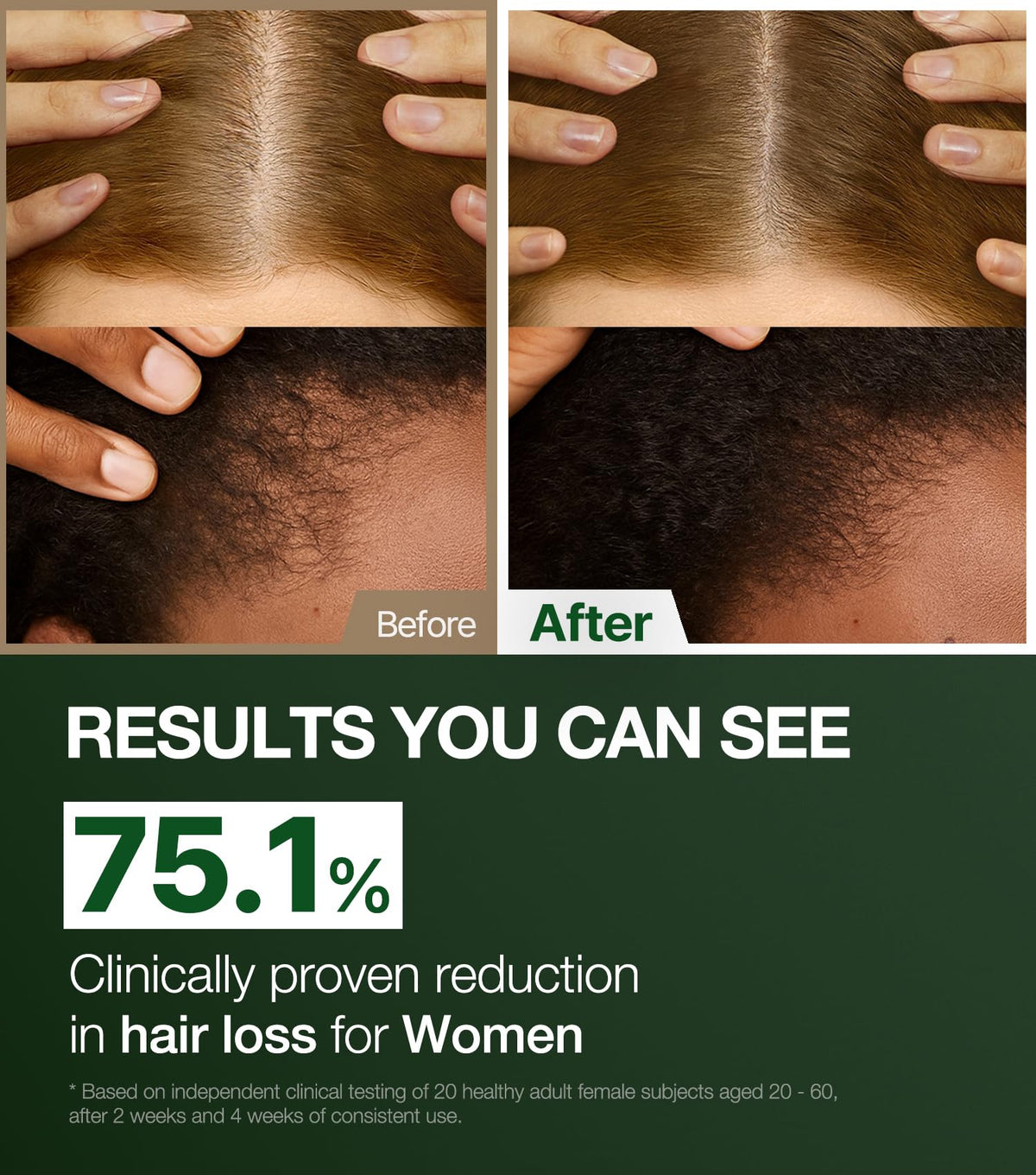 ROOTON back label close-up showing ingredients and Dermatest verification benefits