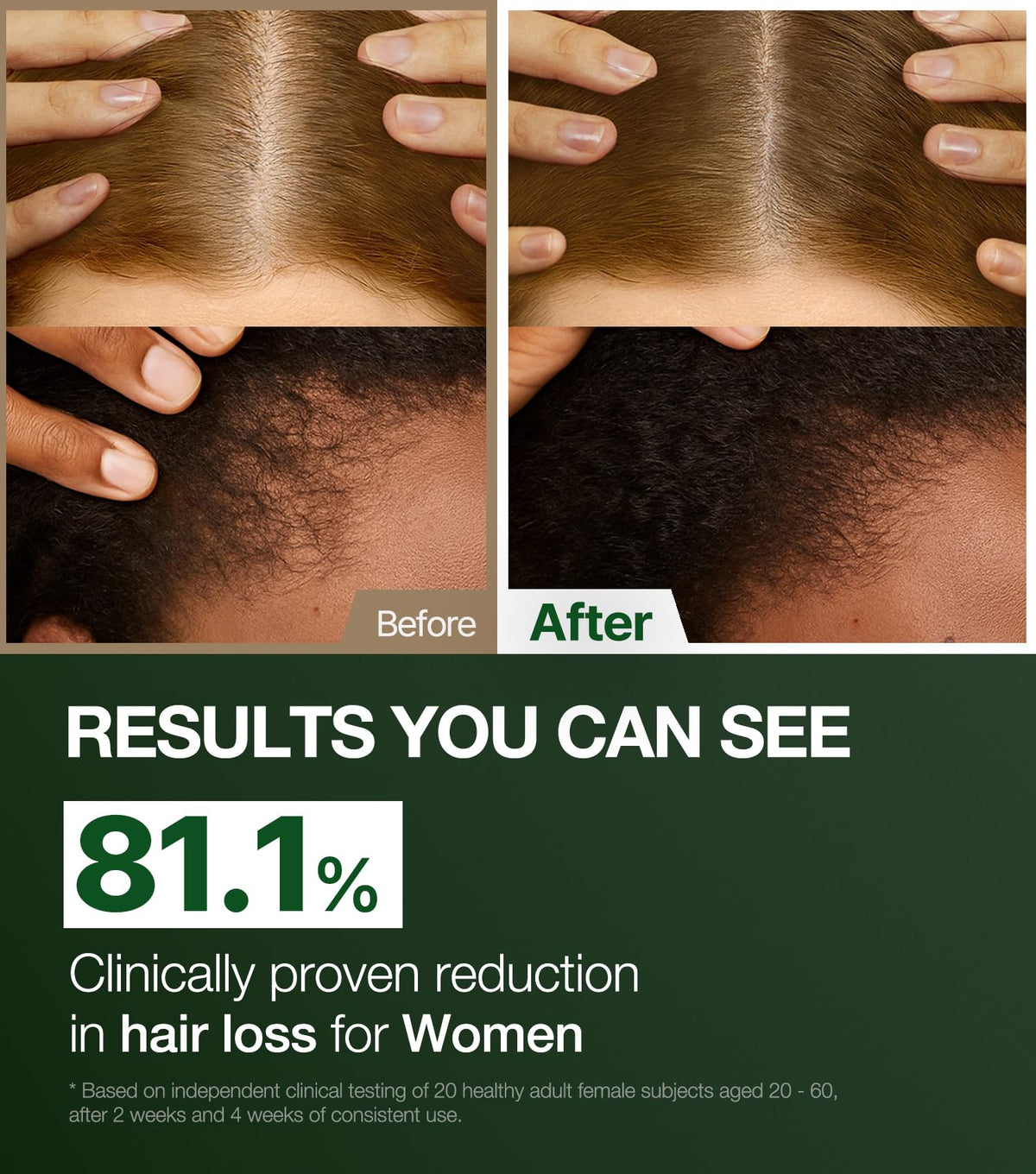 ROOTON label close-up highlighting certification and ingredient focus