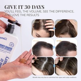 RootStim in shower application demonstrating scalp massage benefit