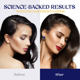 RootStim ingredients label with biotin and herbal extracts for nourishing benefit