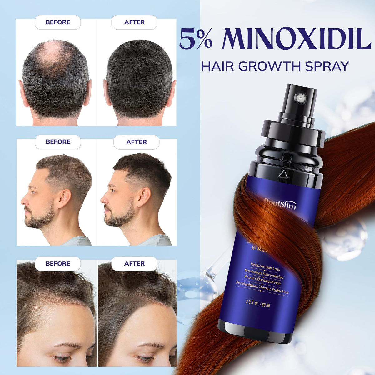 RootStim clear label with active 5% minoxidil and rosemary ingredient list