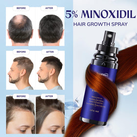 RootStim clear label with active 5% minoxidil and rosemary ingredient list