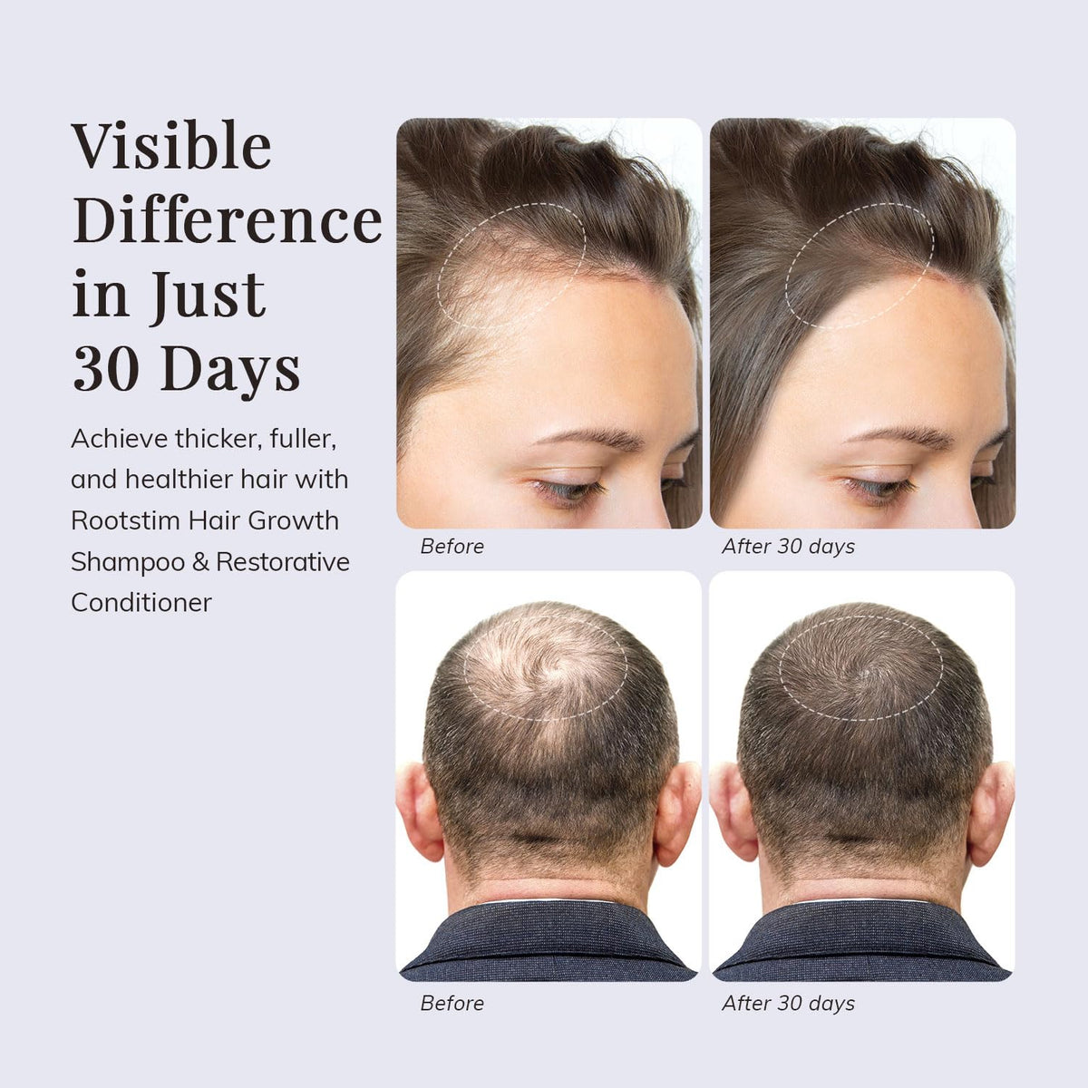 RootStim set in bathroom scene promoting everyday use and scalp comfort