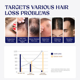 RootStim spray nozzle detail highlighting precise dosage and easy application benefit