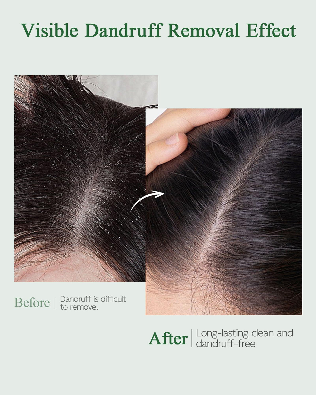 Ropink mugwort extract plant close-up calming redness and soothing scalp
