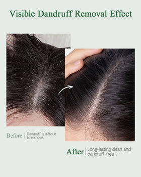 Ropink mugwort extract plant close-up calming redness and soothing scalp