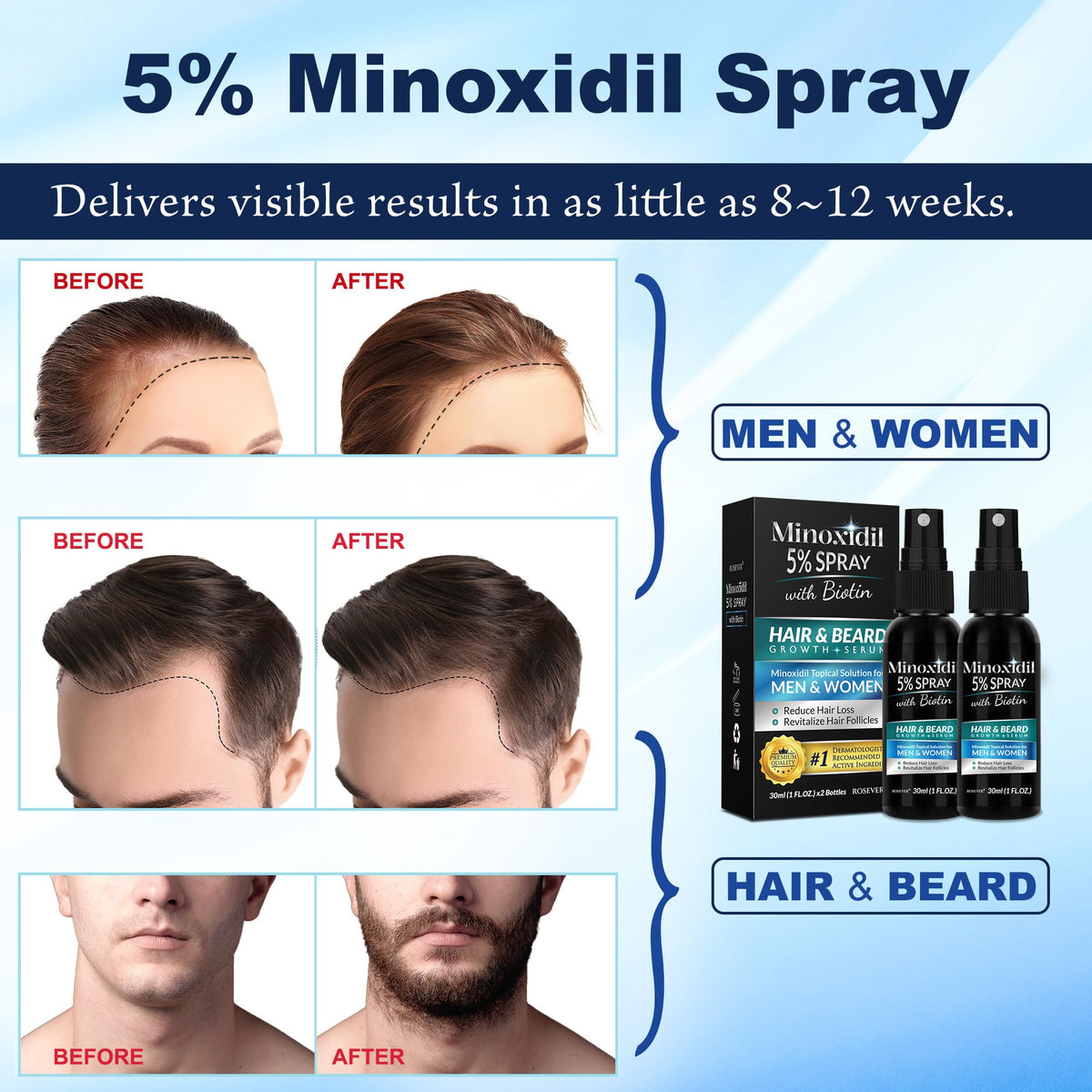 Rosever product texture on scalp close-up showing quick absorption benefit