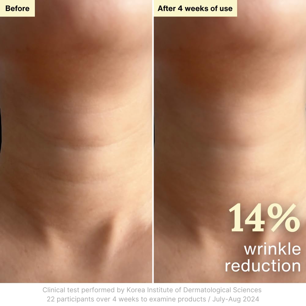 Rothea cream on fingers illustrating smooth spreadability and hydration