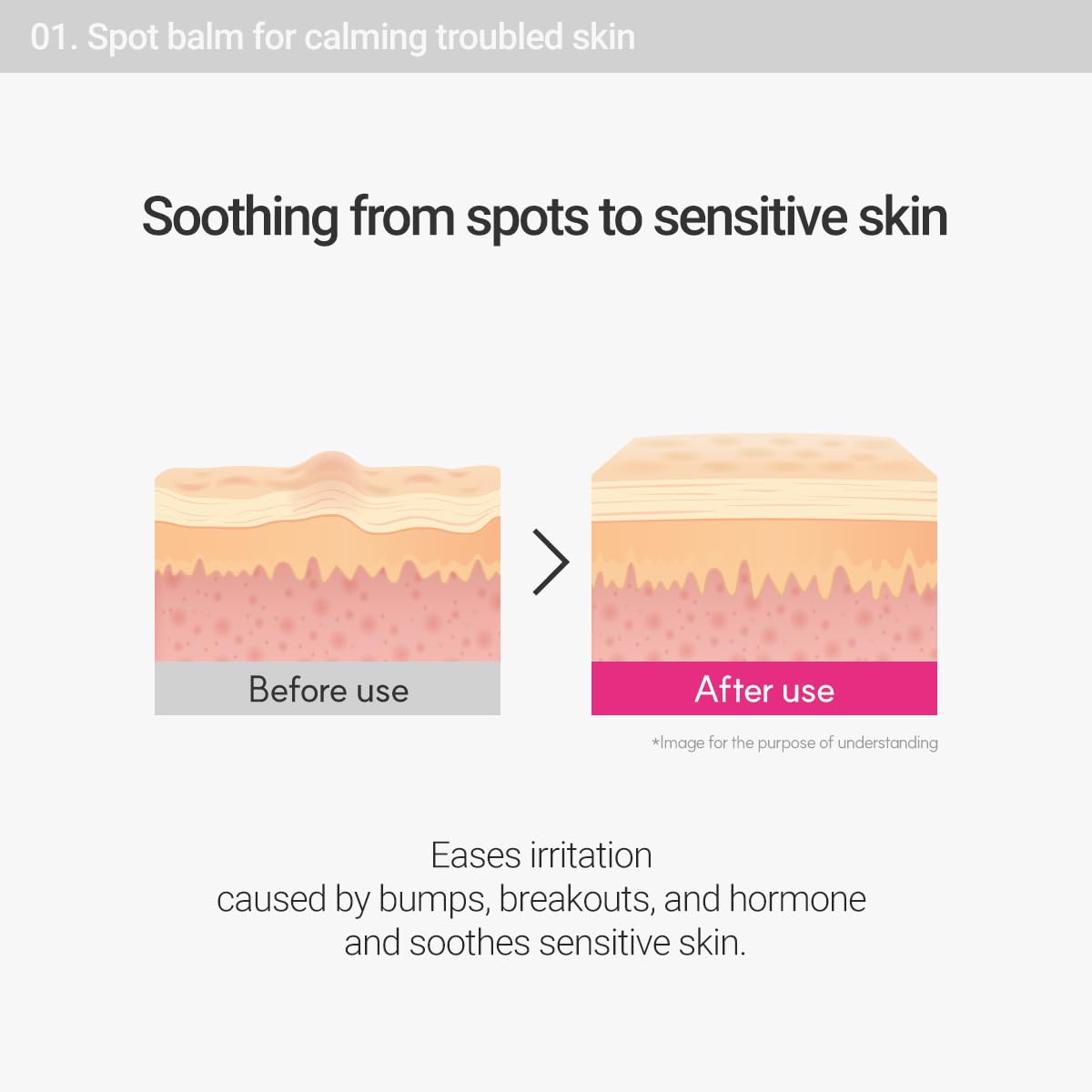 ROVECTIN spot treatment dabbed on cheek to reduce redness