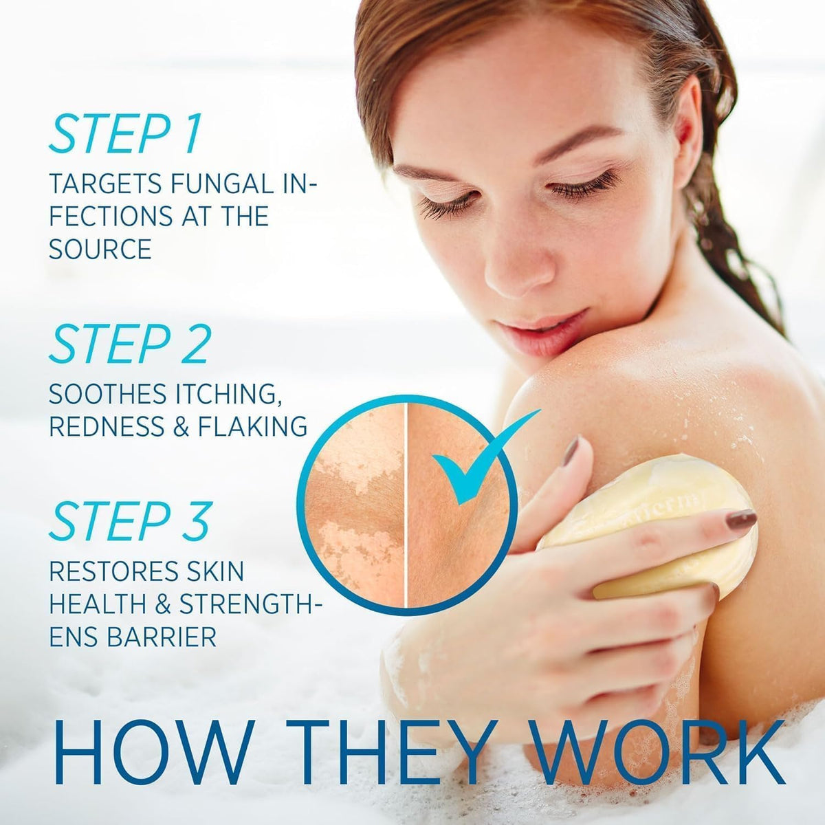 Roycederm cream applied to forearm demonstrating targeted soothing benefit