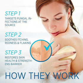 Roycederm cream applied to forearm demonstrating targeted soothing benefit