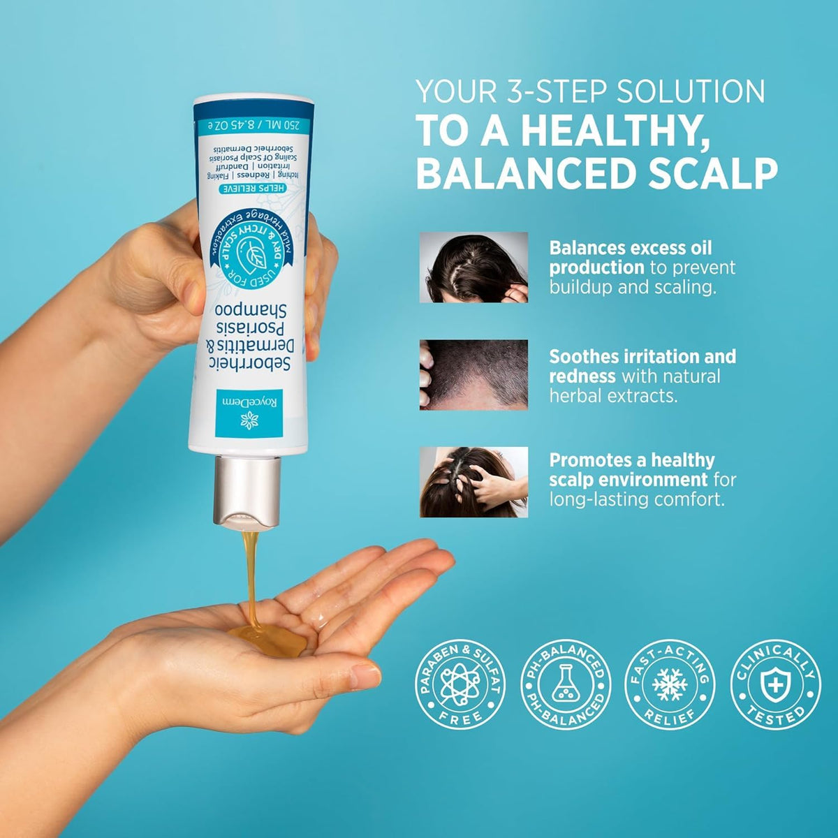 roycederm applying shampoo to scalp illustrating targeted flake removal benefit
