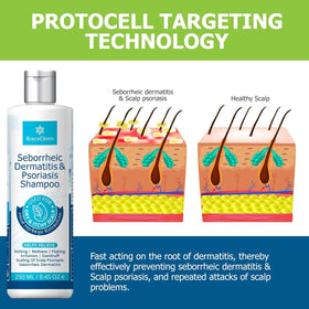 Roycederm being applied to wet hands showing targeted scalp application for relief