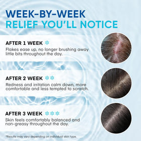 Close-up of Roycederm shampoo lather illustrating mild foaming and comfortable cleanse
